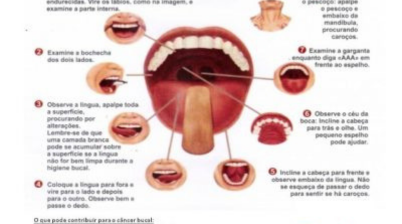 cancer bucal como prevenir)